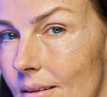 Microneedling Patches